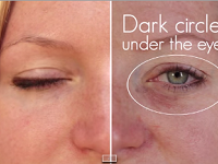 How Sleep Loss Affects Your Face How Sleep Loss Affects Your Face
