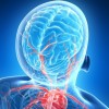 It Doesn't Take Long For Sleep Apnea to Impact Brain Arteries