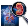 Sleep Apnea May Accelerate  Chronic Kidney Disease